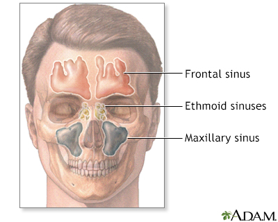 sinus drain that stinks