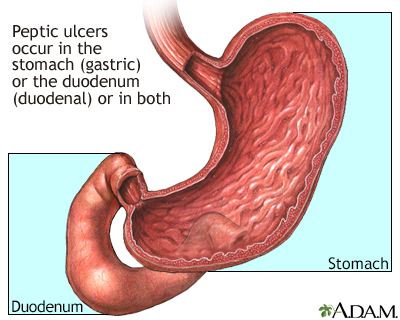 can tramadol cause gastritis