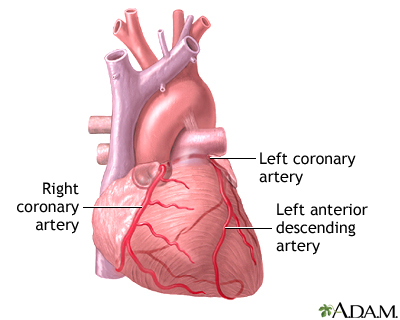 Heart bypass surgery - series